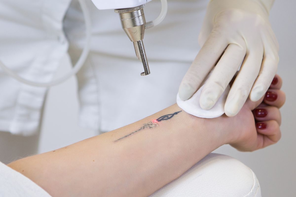 Tatuaggi, questo colore è il più pericoloso